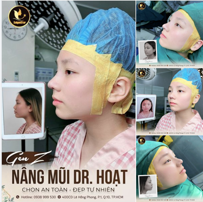 GEN Z NÂNG MŨI DR. HOẠT CHỌN AN TOÀN – ĐẸP TỰ NHIÊN