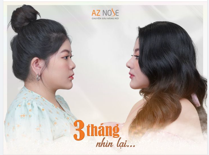 "Mình từng rất stress vì phải chỉnh sóng mũi trong từng tấm hình... Bây giờ thì khác rồi, mình tự tin thể hiện mọi góc mặt khi chụp ảnh hay livestream, nhờ vậy mà công việc phát triển hơn hẳn."