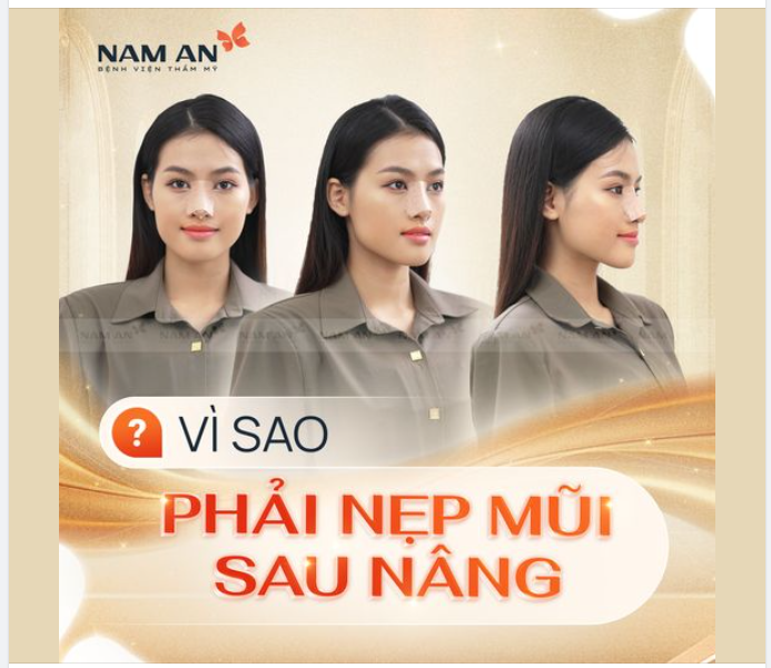 NHẤT ĐỊNH PHẢI NẸP MŨI SAU KHI NÂNG