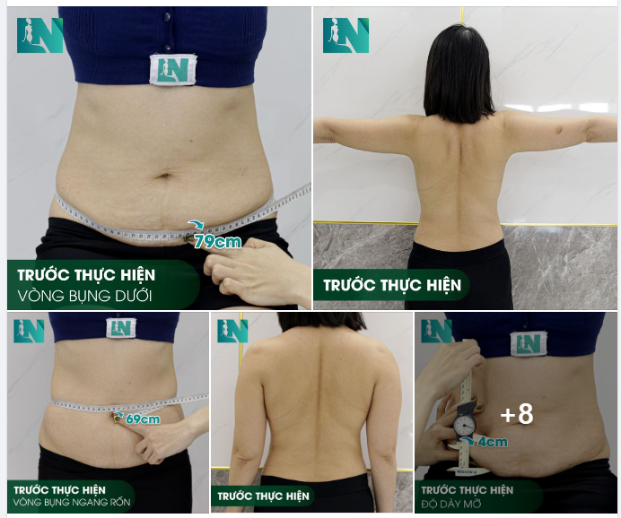 GIẢI PHÁP TÔN TẠO DÁNG VÓC TOÀN DIỆN CHO CHỊ KHÁCH 8X
