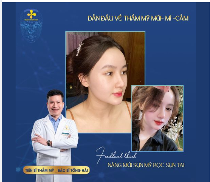 SAO MŨI THẤP THẾ? NHÌN MẶT CHẢ THẤY MŨI ĐÂU