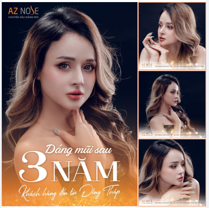 Khách hàng đến từ Đồng Tháp. Trở thành dáng vẻ mình yêu thích nhất sau 3 năm nâng mũi