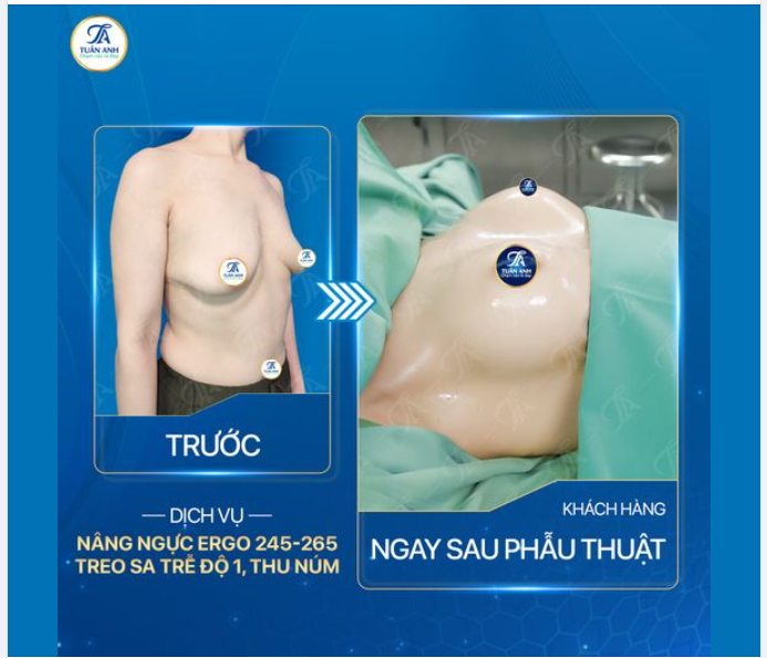 Khoản đầu tư tốt nhất chính là khoản đầu tư vào bản thân mình