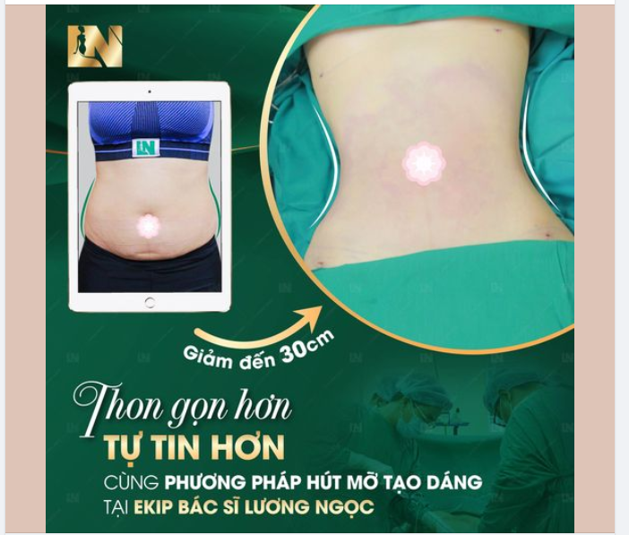 “LỰA CHỌN HÚT MỠ TẠO DÁNG LÀ LỰA CHỌN ĐÚNG ĐẮN NHẤT CỦA CHỊ”