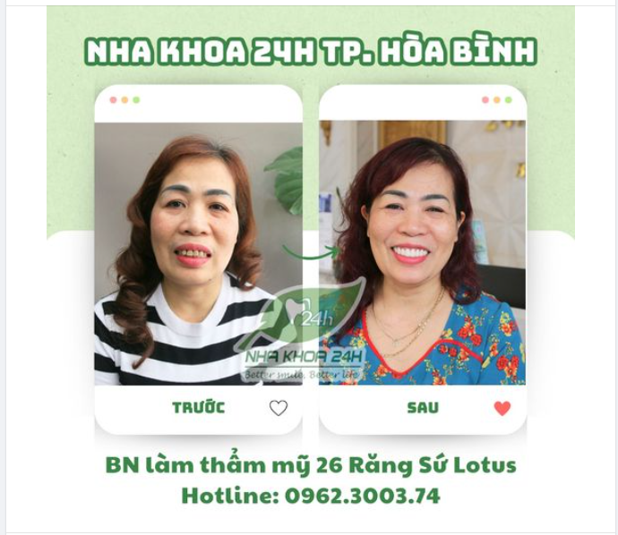 Nụ cười đẹp và tự tin của bệnh nhân chính là món quà tuyệt vời nhất dành cho chúng tôi.