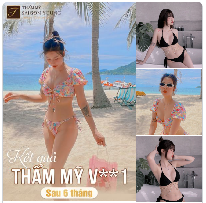 1 LẦN QUYẾT ĐỊNH, TRĂM NĂM NGỠ NGÀNG VÌ CÁI ĐẸP