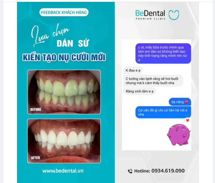 FEEDBACK KHÁCH HÀNG - LỰA CHỌN DÁN SỨ KIẾN TẠO NỤ CƯỜI MỚI