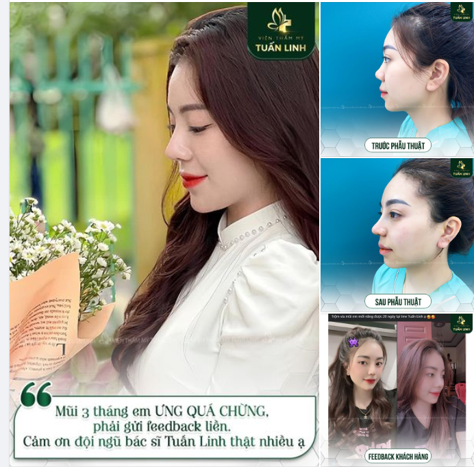 MŨI 3 THÁNG - ƯNG QUÁ CHỪNG!!