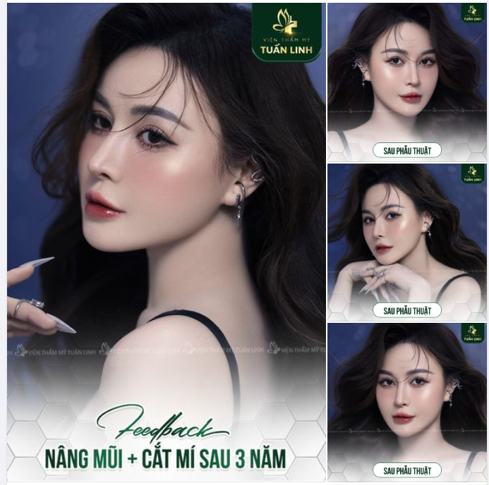 THỜI ĐIỂM VÀNG LÀM ĐẸP ĐÓN TẾT!!