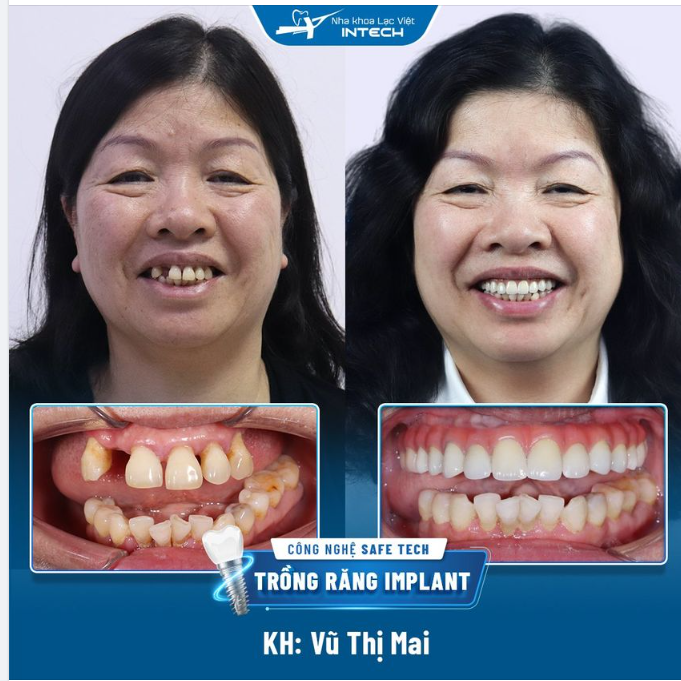 5 NĂM KHÔNG THỂ ĂN NGON, VIỆT KIỀU ĐỨC TÌM THẤY KỲ TÍCH TẠI VIỆT NAM