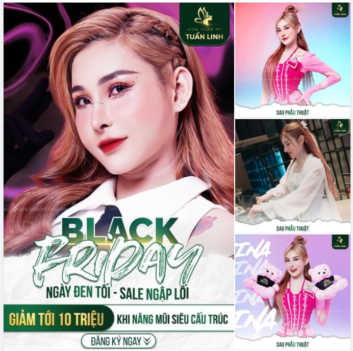 Black Friday - Sale Đậm Sâu - Giảm tới 10triệu khi nâng mũi siêu cấu trúc.