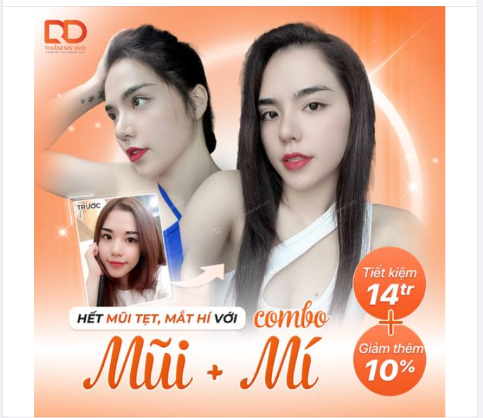 CÔNG THỨC "LỘT XÁC": NÂNG MŨI + CẮT MÍ