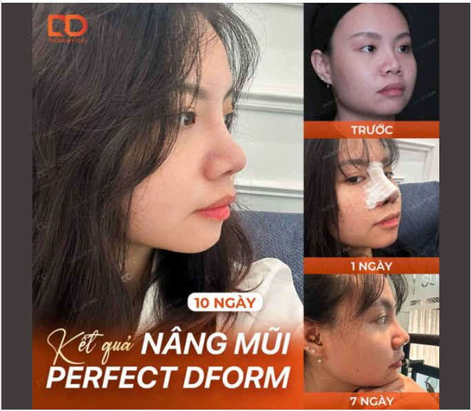 Cùng là góc nghiêng nhưng lần này lạ lắm