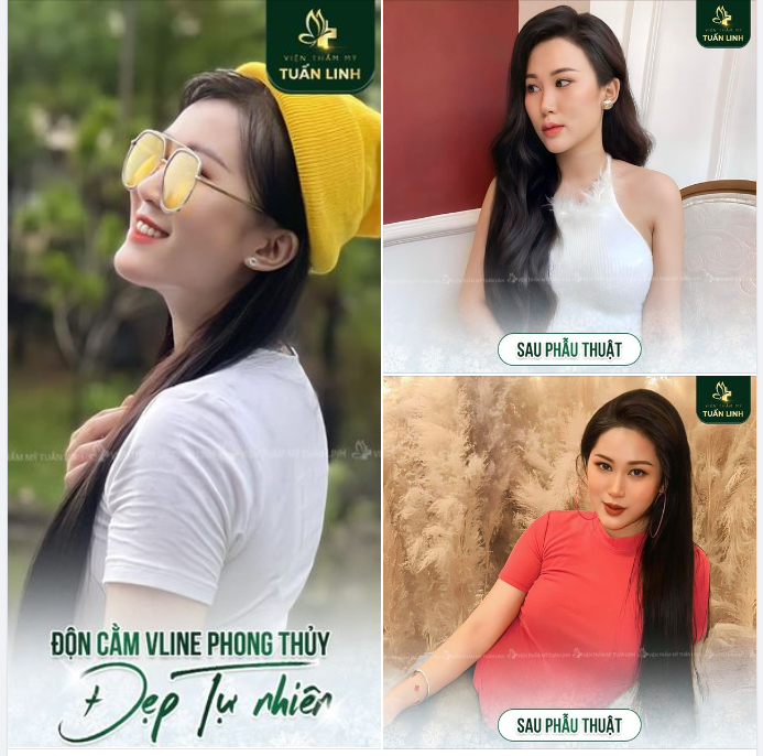 SỞ HỮU DÁNG CẰM SANG CHẢNH CHỈ SAU 45 PHÚT TẠI TUẤN LINH!!