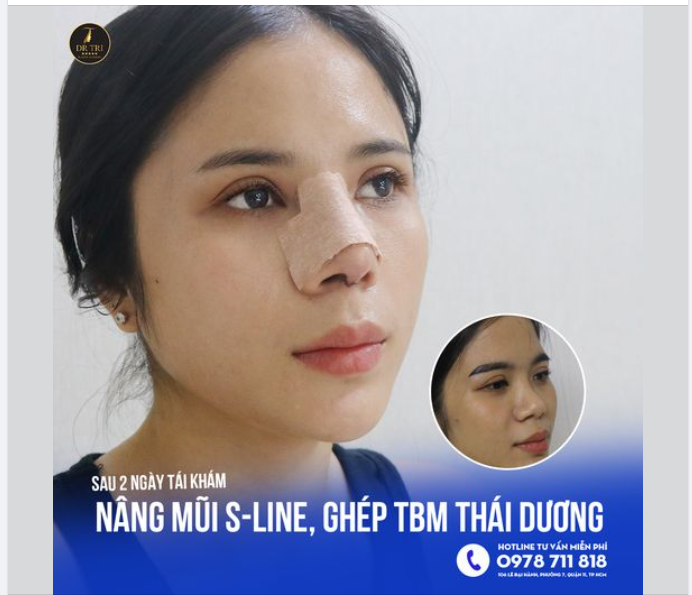 "AI CŨNG KHEN SAU 2 NGÀY MÀ KHÔNG THẤY SƯNG"