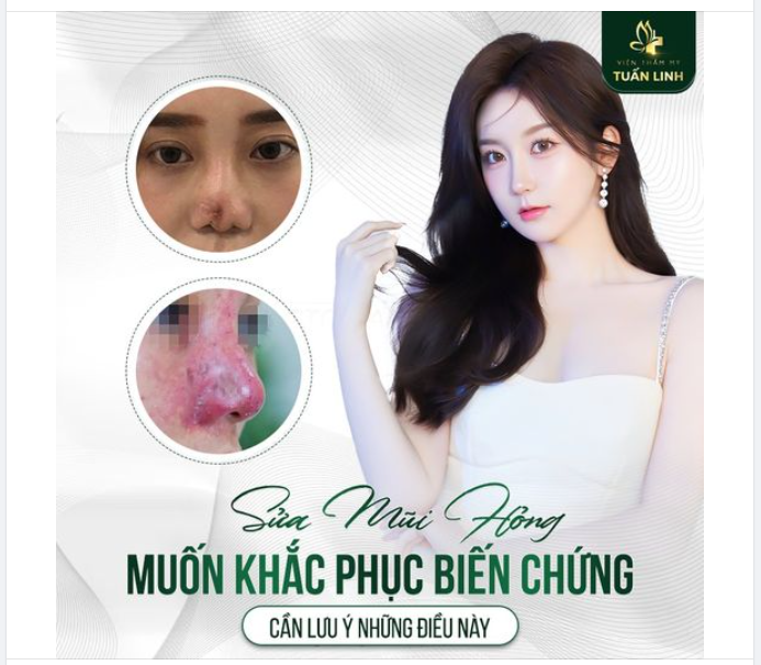 Sửa mũi hỏng: những lưu ý không thể bỏ qua