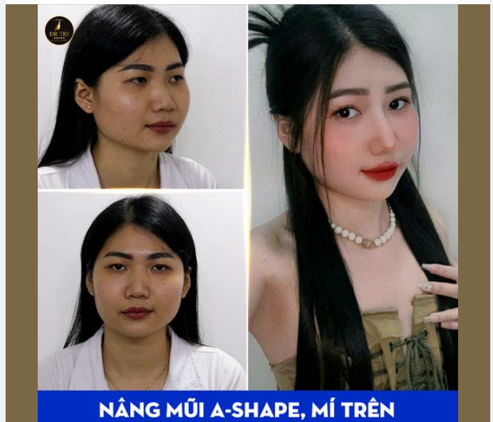HÔM NAY DR TRÍ ĐÃ KẾT THÚC CHƯƠNG TRÌNH ƯU ĐÃI THÁNG 10
