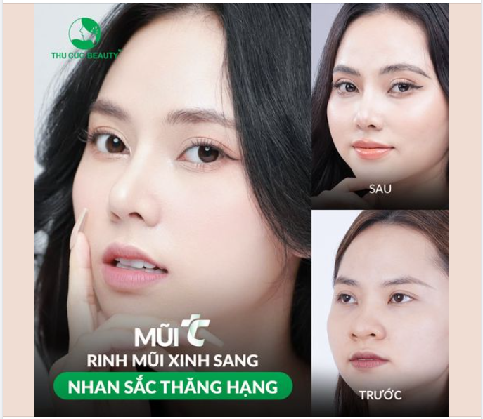  Lựa chọn ngay Mũi TC để khắc phục tình trạng mũi thô, đầu mũi to đẹp ngay sau 15P