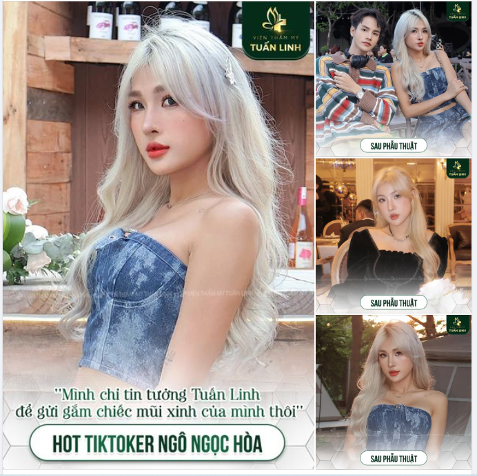'' Mình chỉ tin tưởng Tuấn Linh để gửi gắm chiếc mũi xinh của mình thôi...!"
