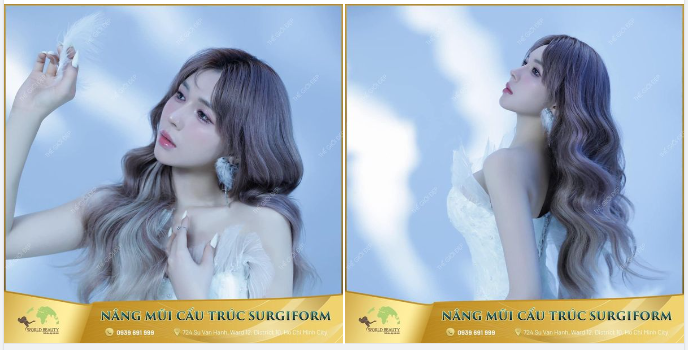 Tái cấu trúc mũi lần thứ ​​​​​​​3 bằng sụn tự thân và thanh Surgiform giúp 9X: