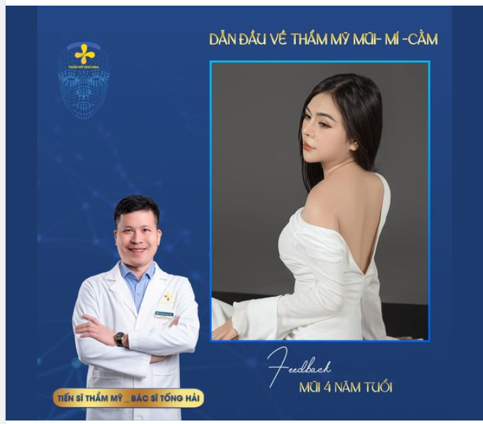 Dáng mũi sau 4 năm sẽ như thế nào?