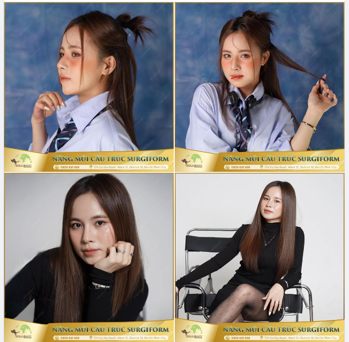 Khác với trước đây nhiều người chuộng mũi cao Tây thì ngược lại form, dáng mũi tự nhiên, vừa phải phù hợp, hài hòa với khuôn mặt lại trở thành xu hướng ở hiện tại.