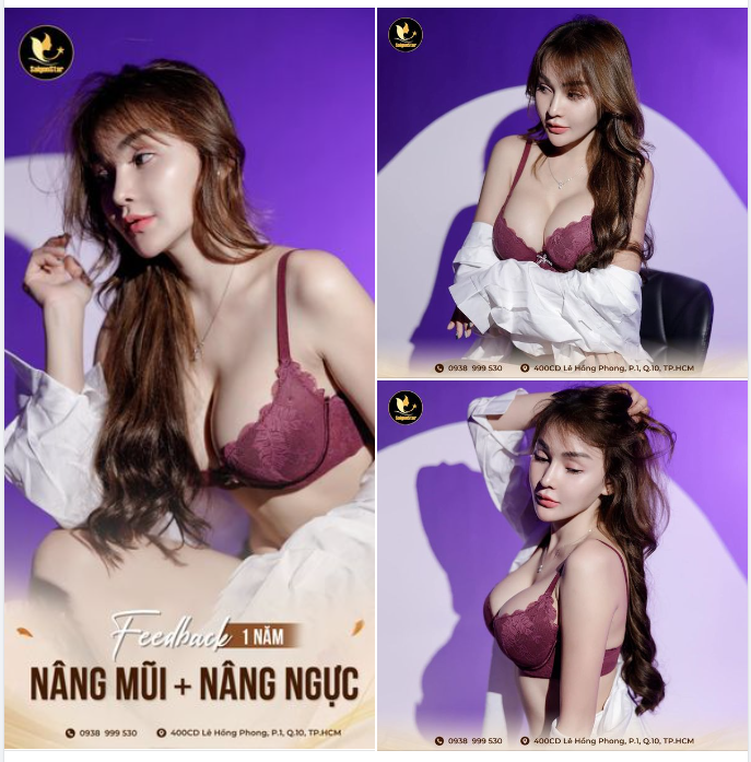 GÓC FEEDBACK Hình ảnh siêu chất lượng của bạn khách sau 1 năm thực hiện combo: