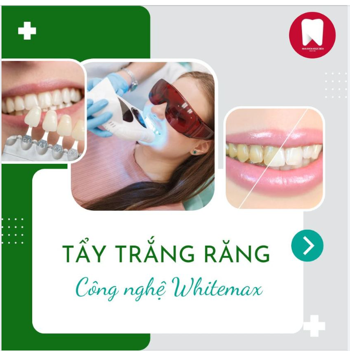 Hàm răng ố vàng, xỉn màu khiến bạn thiếu tự tin khi giao tiếp?