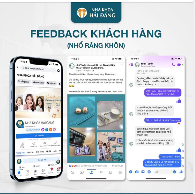 CẢM NHẬN DÒNG FEEDBACK NHỔ RĂNG KHÔN TẠI NHA KHOA HẢI ĐĂNG