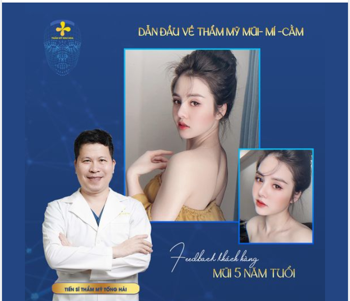 Dáng mũi 5 năm tuổi của khách hàng Giáng Uyên:
