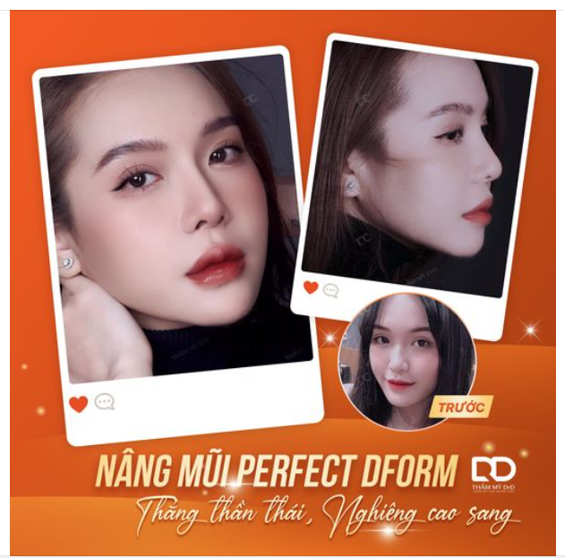 Gấp đôi VISUAL sau phẫu thuật Nâng mũi