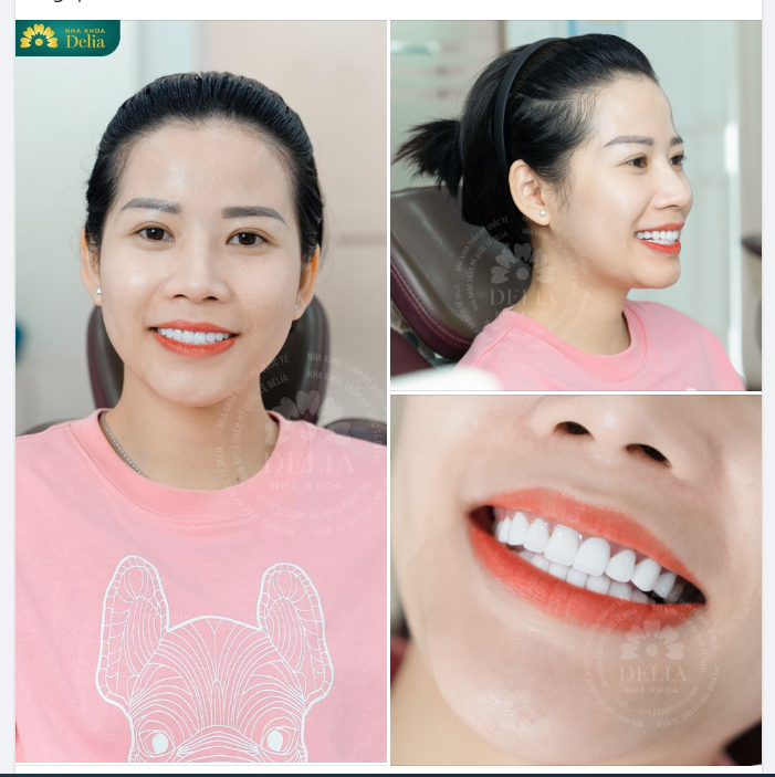 Nụ cười rạng rỡ - Hạnh phúc rạng ngời