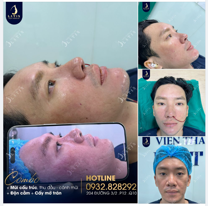 Cùng Latin thực hiện quá trình thay đổi toàn diện cho khách hàng nam