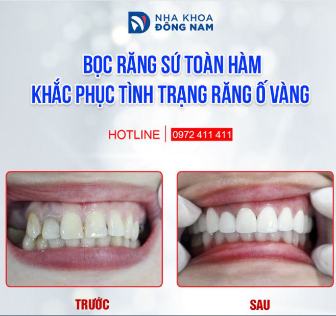 LUÔN CÓ CÁCH ĐỂ GIÚP NỤ CƯỜI BẠN TRÔNG ĐẸP HƠN