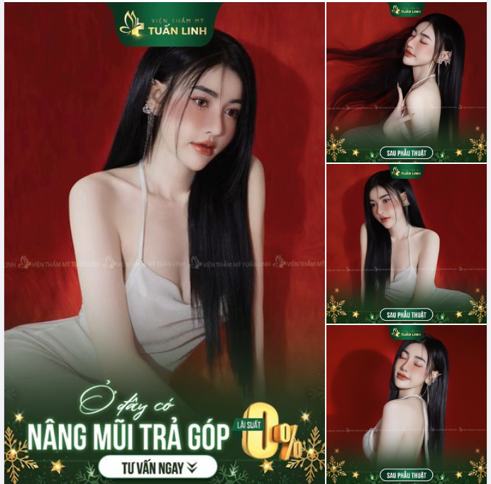 NÂNG MŨI TRẢ GÓP - HỖ TRỢ 0% LÃI - CHỈ CẦN CCCD GẮN CHIP