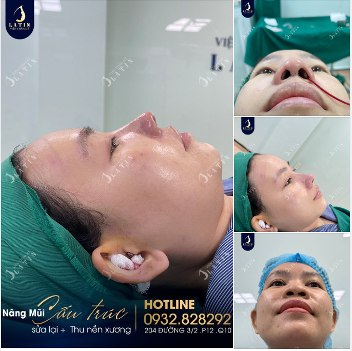 Chỉ cần đẹp, đau bao nhiêu em cũng chịu được