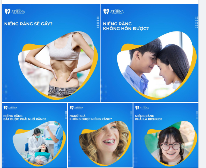 NHỮNG ĐIỀU CẦN BIẾT VỀ NIỀNG RĂNG!