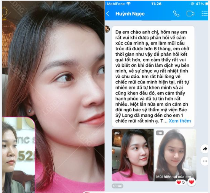 MỘT “TIN NHẮN” NHỎ TRỞ THÀNH NIỀM VUI TO