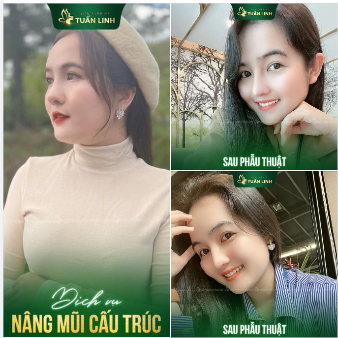 Mũi cao xinh - Rinh tài lộc - Đón năm mới bình an!!