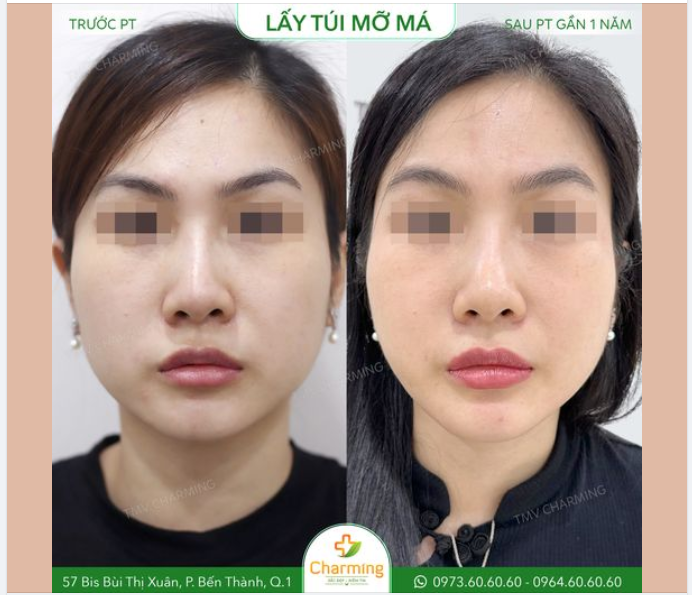 Khuôn mặt tròn trịa này từ lâu đã không còn khiến bạn khách này ưng mắt. Thân hình gọn gàng nhưng khuôn mặt lại khiến cho cả người như một chữ "i".