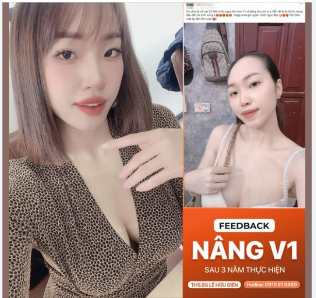 NÂNG NGỰC CÓ CHO CON BÚ ĐƯỢC KHÔNG?