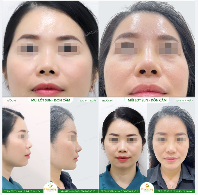 Đừng để góc nhìn ngang từ chiếc mũi cũ của bạn khách này đánh lừa bạn. Mũi cũ chẳng cao như bạn nghĩ đâu ..