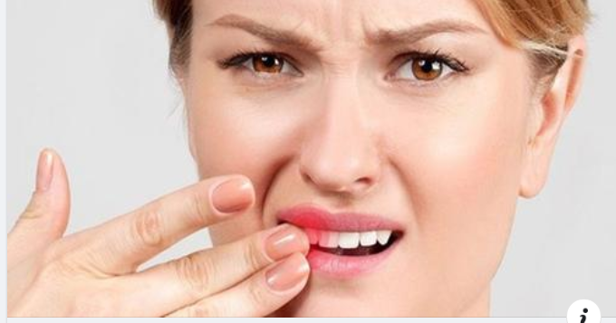 Răng lung lay có cách nào giữ được không?