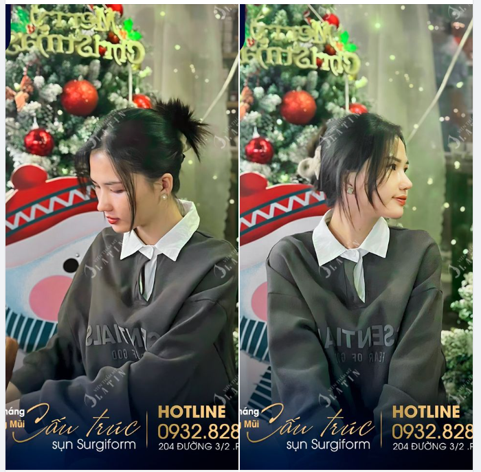 XMAS IS COMING "Tự tin và xinh đẹp như hôm nay, thật đúng đắn vì em đã nâng mũi..."