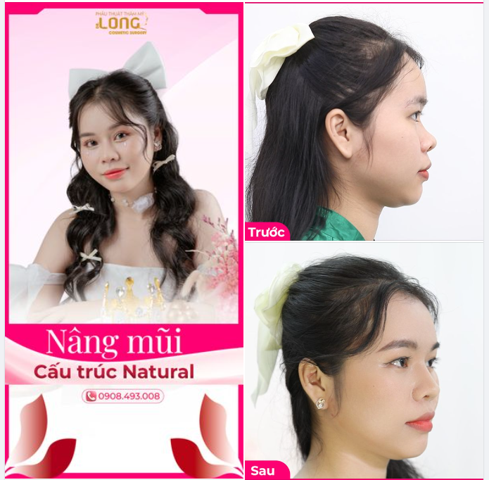 ĐÓN TUỔI MỚI SIÊU XINH CÙNG BỘ ẢNH LUNG LINH