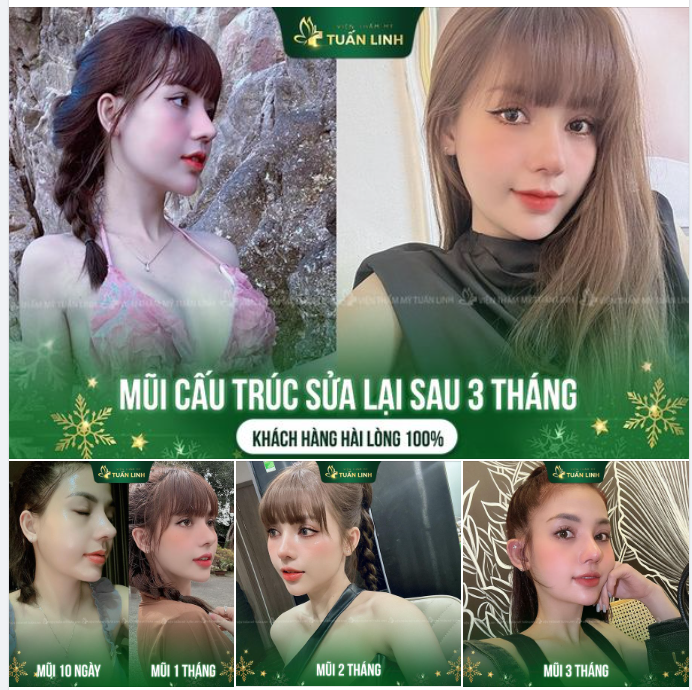 MŨI 3 THÁNG VÀO FORM TUYỆT ĐẸP!!