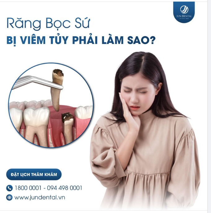 Răng Bọc Sứ Bị Viêm Tủy Phải Làm Sao?