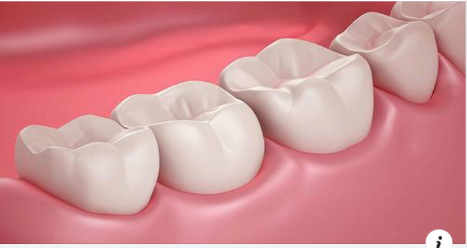 Trám Răng Có Cần Chích Thuốc Tê Không?