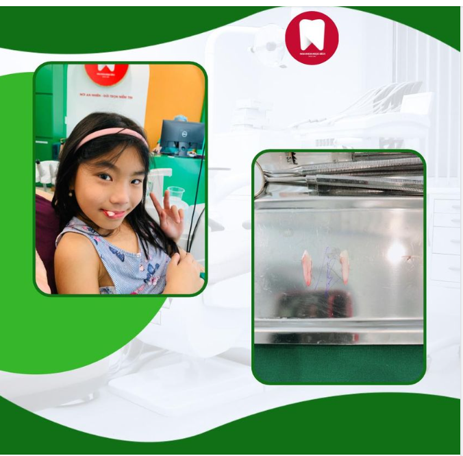 FEEDBACK NHỔ RĂNG TỪ KHÁCH HÀNG NHÍ