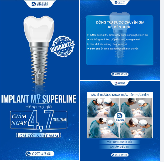 Deal tốt nhất năm, ​​​​​​​giảm ngay 20% Implant Mỹ Superline, chỉ còn 18,8 triệu/răng.